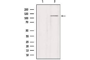 Western blot analysis of extracts from HepG2, using GRID2 Antibody. (GRID2 抗体  (C-Term))