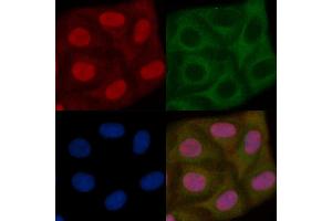 XRRA1 Mouse Monoclonal Antibody staining Hela cells by IF/ICC. (XRRA1 抗体)