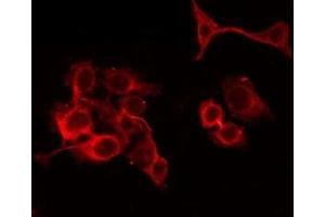 ABIN6279648 staining Hela by IF/ICC. (PAOX 抗体  (Internal Region))