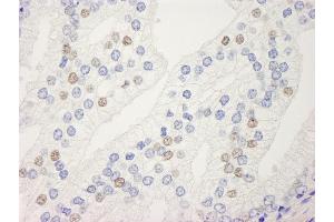 anti-Uveal Autoantigen With Coiled Coil Domains And Ankyrin Repeats (UACA) (AA 1-50) antibody