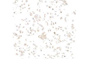 Immunocytochemistry (ICC) image for anti-Met Proto-Oncogene (MET) (C-Term) antibody (ABIN7795683) (Recombinant c-MET 抗体  (C-Term))