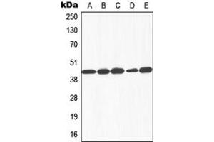 Western blot analysis of Galactose Kinase expression in HEK293T (A), HepG2 (B), SP2/0 (C), rat liver (D), Human liver (E) whole cell lysates.