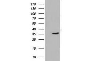 Western Blotting (WB) image for anti-Short Chain Dehydrogenase/reductase Family 9C, Member 7 (SDR9C7) antibody (ABIN1500846) (SDR9C7 抗体)