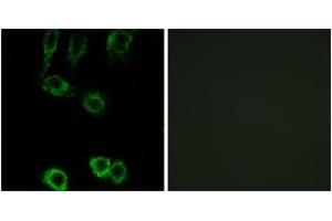 Immunofluorescence analysis of A549 cells, using CNN2 Antibody. (CNN2 抗体  (AA 121-170))