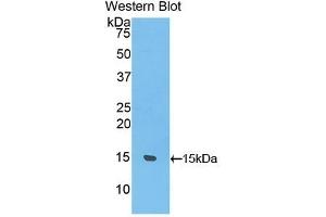 Detection of Recombinant UCP1, Rat using Polyclonal Antibody to Uncoupling Protein 1, Mitochondrial (UCP1) (UCP1 抗体  (AA 179-296))