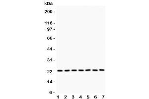 Western blot testing of GSTP1 antibody and Lane 1:  rat brain (GSTP1 抗体  (AA 2-210))