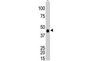 The CKB polyclonal antibody  is used in Western blot to detect CKB in Y-79 cell lysate . (CKB 抗体  (N-Term))