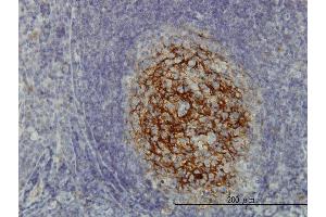 Immunoperoxidase of monoclonal antibody to SDCBP on formalin-fixed paraffin-embedded human tonsil. (SDCBP 抗体  (AA 1-100))