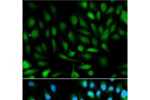 Immunofluorescence analysis of HeLa cells using PARK7 Polyclonal Antibody (PARK7/DJ1 抗体)