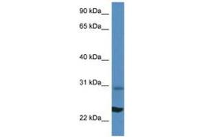 Image no. 1 for anti-Ribosomal Protein L17 (RPL17) (N-Term) antibody (ABIN6746438) (RPL17 抗体  (N-Term))