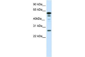 WB Suggested Anti-FOXD1 Antibody Titration:  0. (FOXD1 抗体  (N-Term))