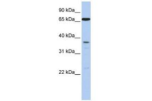 ABCB9 antibody used at 1 ug/ml to detect target protein. (ABCB9 抗体)
