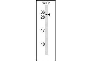 Western blot analysis of ANKRA1 / RFXANK Antibody  in WiDr cell line lysates (35ug/lane).
