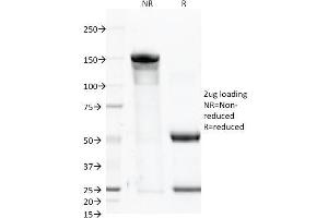SDS-PAGE Analysis Purified CD46 Mouse Monoclonal Antibody (122. (CD46 抗体)