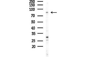 anti-Calcium Responsive Transcription Factor (CARF) (Internal Region) antibody