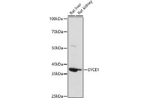 Western blot analysis of extracts of various cell lines, using (ABIN6132916, ABIN6148756, ABIN6148757 and ABIN6223050) at 1:1000 dilution. (SYCE1 抗体  (AA 132-351))
