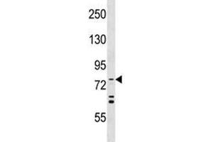 Western Blotting (WB) image for anti-ATG7 Autophagy Related 7 (ATG7) (AA 494-523) antibody (ABIN3028482)