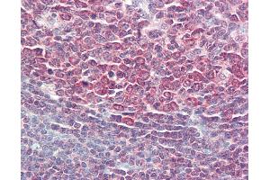 Immunohistochemistry (IHC) image for anti-Protein Phosphatase 1, Regulatory (Inhibitor) Subunit 10 (PPP1R10) (AA 350-400) antibody (ABIN2627091)