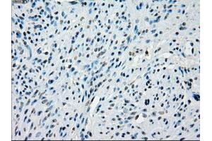Immunohistochemical staining of paraffin-embedded colon tissue using anti-KDM4C mouse monoclonal antibody. (KDM4C 抗体)