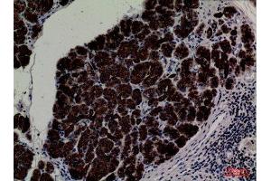 Immunohistochemistry (IHC) analysis of paraffin-embedded Human Pancreas, antibody was diluted at 1:100. (CD1e 抗体  (C-Term))