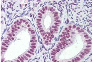 Human Uterus (formalin-fixed, paraffin-embedded) stained with MORF4L1 antibody ABIN462283 followed by biotinylated anti-goat IgG secondary antibody ABIN481715, alkaline phosphatase-streptavidin and chromogen. (MORF4L1 抗体  (AA 2-14))