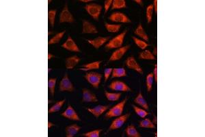 Immunofluorescence analysis of L929 cells using TMX2 antibody (ABIN7270810) at dilution of 1:100.