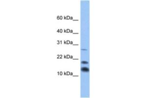 Western Blotting (WB) image for anti-C1D Nuclear Receptor Corepressor (C1D) antibody (ABIN2463345) (C1D 抗体)