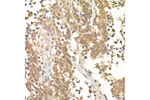 Immunohistochemistry (IHC) image for anti-Catenin (Cadherin-Associated Protein), beta 1, 88kDa (CTNNB1) antibody (ABIN7266138)