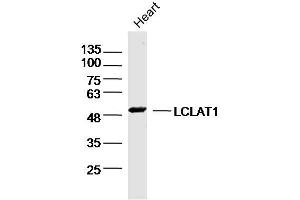Mouse heart lysates probed with LCLAT1 Polyclonal Antibody, Unconjugated  at 1:300 dilution and 4˚C overnight incubation. (LCLAT1 抗体  (AA 261-360))