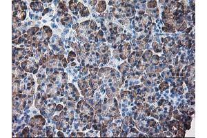 Image no. 1 for anti-Ribophorin 1 (RPN1) antibody (ABIN1500754) (RPN1 抗体)