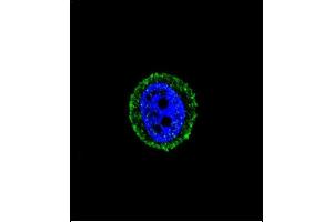 Confocal immunofluorescent analysis of CALCR Antibody (C-term) (ABIN651875 and ABIN2840433) with MCF-7 cell followed by Alexa Fluor® 488-conjugated goat anti-rabbit lgG (green). (Calcitonin Receptor 抗体  (AA 465-494))