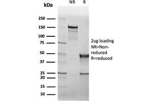 SDS-PAGE Analysis Purified CFTR Recombinant Mouse Monoclonal Antibody (rCFTR/6476).
