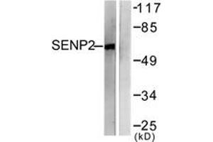 Western blot analysis of extracts from MDA-MB-435 cells, using SENP2 Antibody. (SENP2 抗体  (AA 481-530))