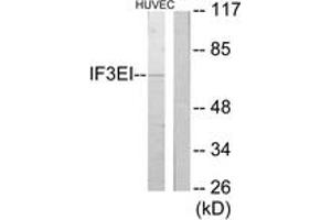 Western blot analysis of extracts from HuvEc cells, using IF3EI Antibody. (EIF3L 抗体  (AA 1-50))