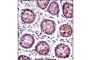 HEXIM1 Antibody (N-term) (ABIN657913 and ABIN2846861) immunohistochemistry analysis in formalin fixed and paraffin embedded human colon tissue followed by peroxidase conjugation of the secondary antibody and DAB staining. (HEXIM1 抗体  (N-Term))