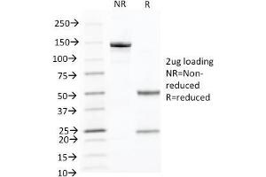 SDS-PAGE Analysis Purified Cytokeratin 10 Monoclonal Antibody (KRT10/844). (Keratin 10 抗体)