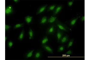 Immunofluorescence (IF) image for anti-Proteasome (Prosome, Macropain) Subunit, beta Type, 6 (PSMB6) (AA 1-239) antibody (ABIN562482)