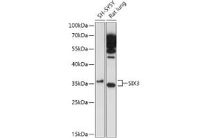 Western blot analysis of extracts of various cell lines, using SIX3 antibody (ABIN7270319) at 1:1000 dilution.