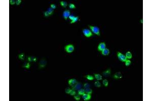 Immunofluorescence staining of PC-3 cells with ABIN7173868 at 1:40, counter-stained with DAPI. (RELT 抗体  (AA 26-153))