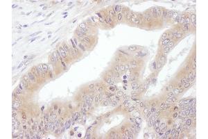 Immunohistochemistry (IHC) image for anti-Eukaryotic Translation Initiation Factor 3 Subunit E (EIF3E) (AA 50-100) antibody (ABIN7454890)