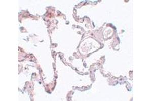 Immunohistochemistry (IHC) image for anti-Pleckstrin Homology Domain Containing, Family M (With RUN Domain) Member 1 (PLEKHM1) (N-Term) antibody (ABIN1031519) (PLEKHM1 抗体  (N-Term))