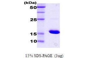 Figure annotation denotes ug of protein loaded and % gel used. (DnaK (AA 385-546) Peptide)