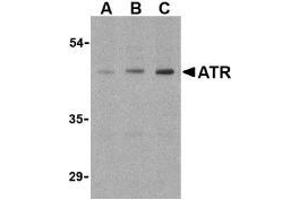 Western blot analysis of ATR in HepG2 cell lysates with this product atR antibody (IN) at (A) 0. (ANTXR1 抗体  (Intermediate Domain))