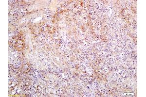 Formalin-fixed and paraffin embedded rat colon carcinoma labeled with Anti-Slc22A17 Y Polyclonal Antibody, Unconjugated  at 1:300, followed by conjugation to the secondary antibody and DAB staining