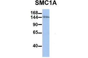 Host:  Rabbit  Target Name:  SMC1A  Sample Type:  Human Jurkat  Antibody Dilution:  1. (SMC1A 抗体  (C-Term))