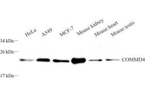 Western blot analysis of COMMD4 (ABIN7073559) at dilution of 1: 250 (COMMD4 抗体)