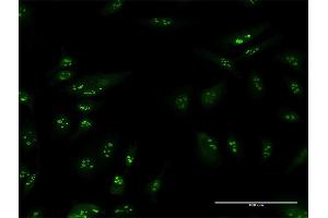 Immunofluorescence of purified MaxPab antibody to TSPYL6 on HeLa cell. (TSPY-Like 6 抗体  (AA 1-410))