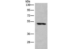 Western blot analysis of Human placenta tissue lysate using KLHDC2 Polyclonal Antibody at dilution of 1:400 (KLHDC2 抗体)