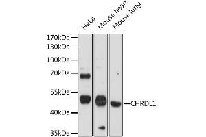 Western blot analysis of extracts of various cell lines, using CHRDL1 antibody (ABIN6292367) at 1:1000 dilution.