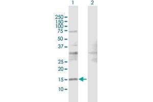 Western Blot analysis of SRP19 expression in transfected 293T cell line by SRP19 MaxPab polyclonal antibody. (SRP19 抗体  (AA 1-144))